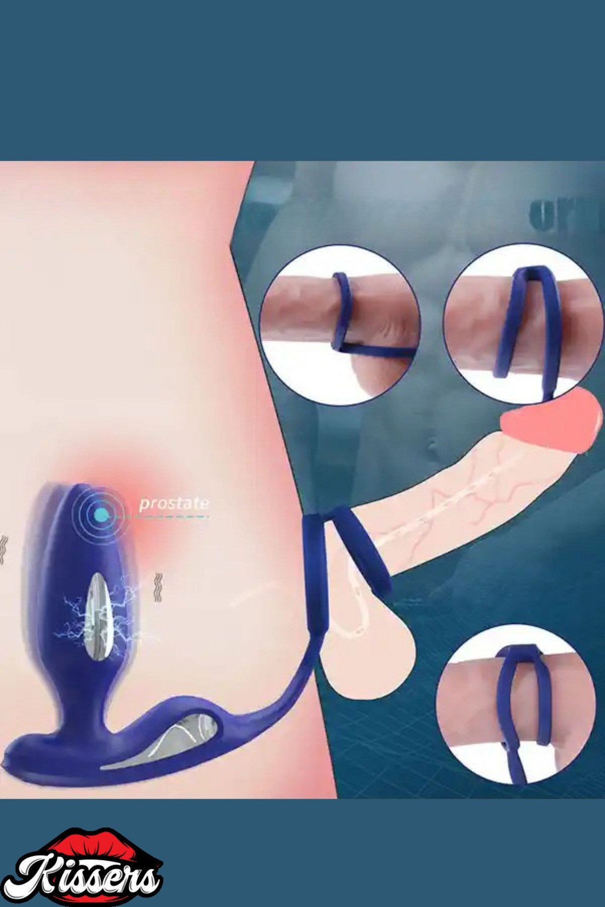 Penis Halkalı ve Şok Özellikli Anal Vibratör